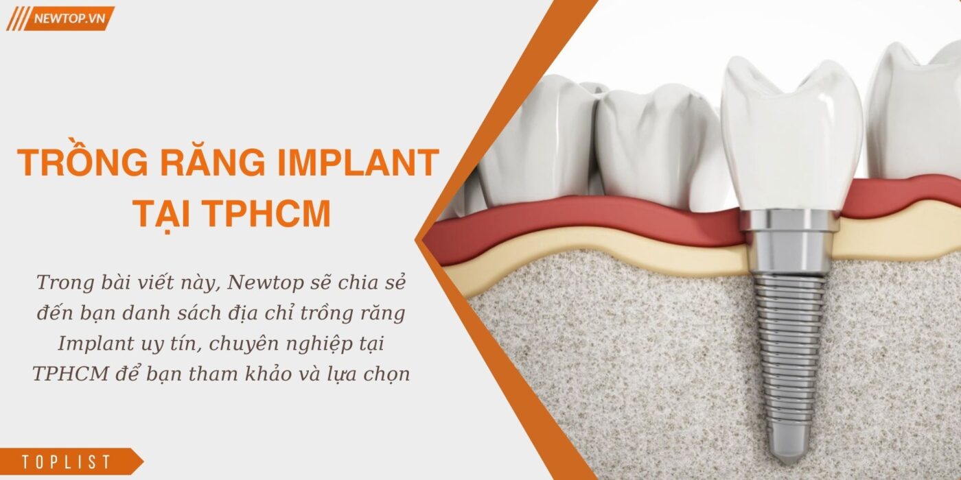 trồng răng implant tại tphcm